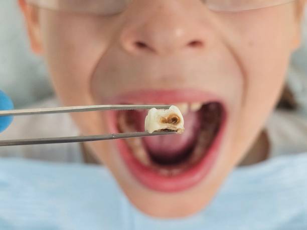 Best Pediatric Emergency Dentist in Commerce, TX